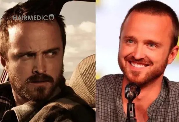 Did Aaron Paul Get a Hair Transplant? Facts and Speculations