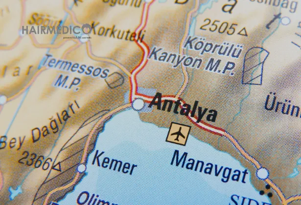 Antalya Hair Transplant Price 2025
