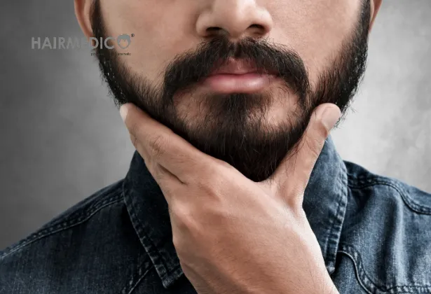 Beard Transplant: How It Works, Common Issues & What to Expect