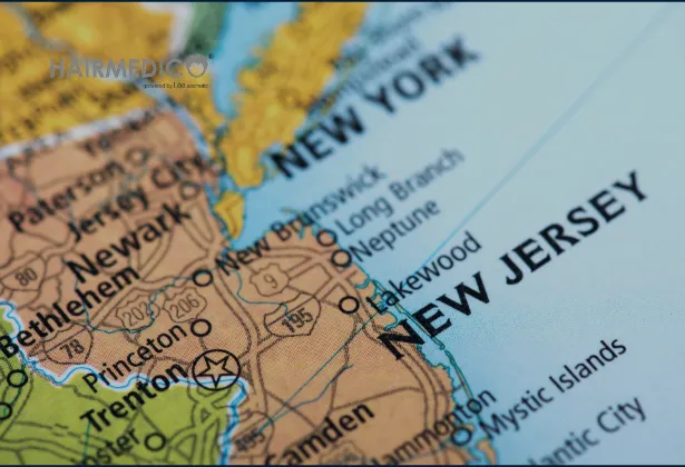 Best Hair Transplant in New Jersey 2025