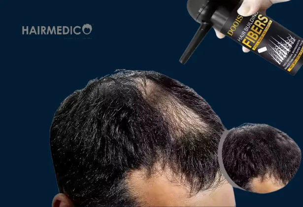 Can You Use Hair Fibers After a Hair Transplant? Best Practices & Expert Tips