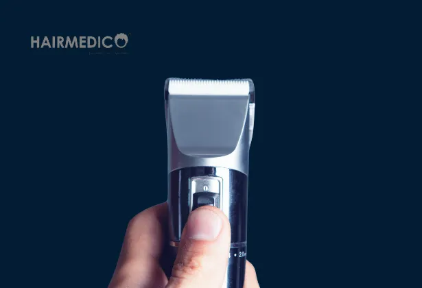 No-Shave Hair Transplant in Turkey – Hairmedico Istanbul Prices & Benefits