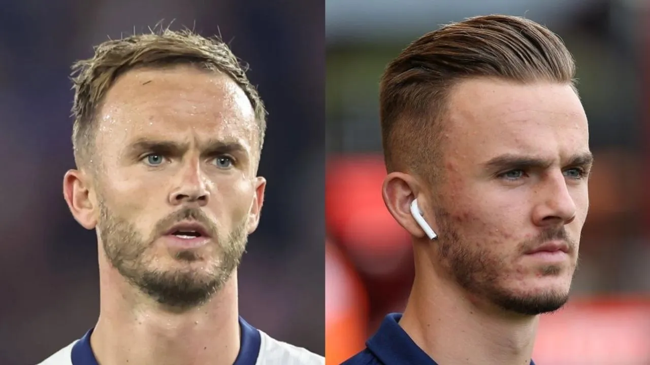 Did James Maddison have a hair transplant? Discover the truth about his hair transformation